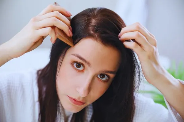 Psoriasis